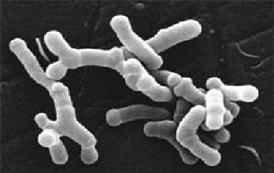 Lactobacillus acidophilus